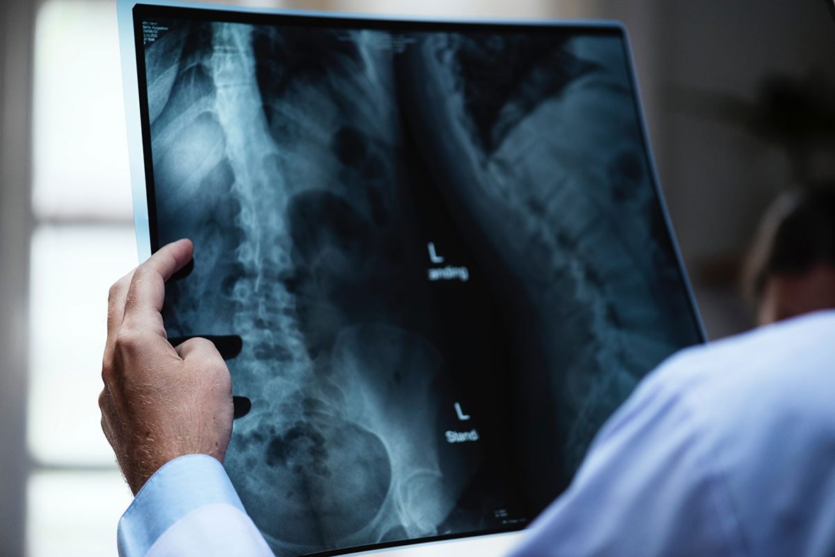 Medical Device Lawsuits